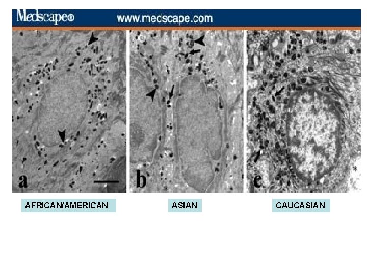 AFRICAN/AMERICAN ASIAN CAUCASIAN AFRICAN/AMERICAN ASIAN CAUCASIAN