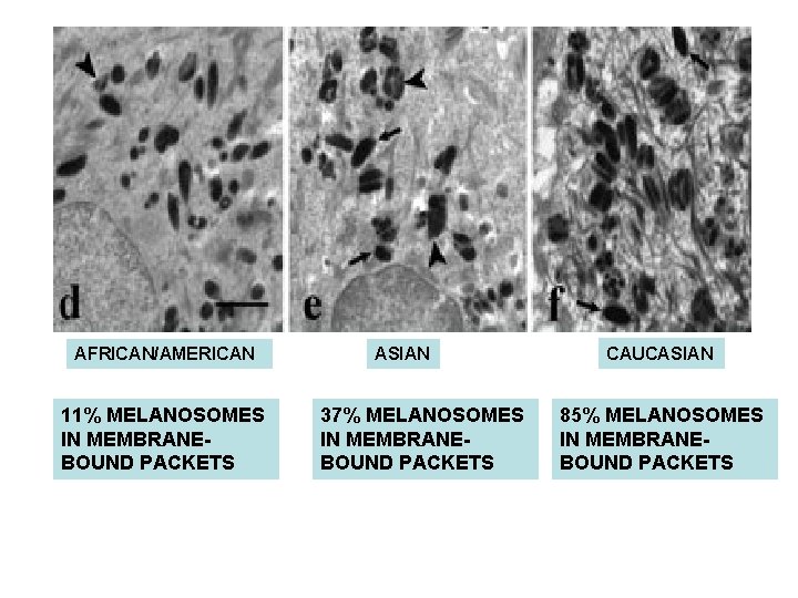 AFRICAN/AMERICAN 11% MELANOSOMES IN MEMBRANEBOUND PACKETS ASIAN 37% MELANOSOMES IN MEMBRANEBOUND PACKETS CAUCASIAN 85% AFRICAN/AMERICAN 11% MELANOSOMES IN MEMBRANEBOUND PACKETS ASIAN 37% MELANOSOMES IN MEMBRANEBOUND PACKETS CAUCASIAN 85%
