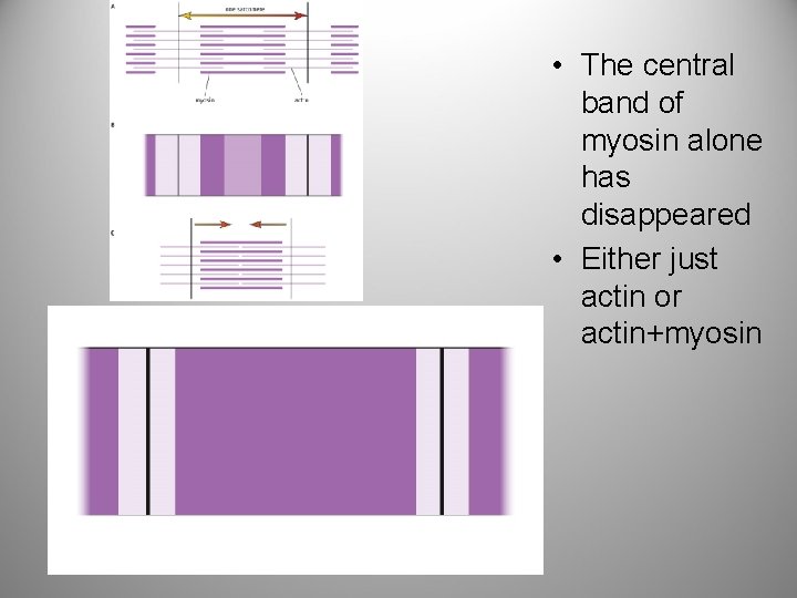  • The central band of myosin alone has disappeared • Either just actin
