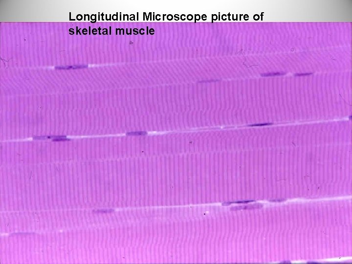 Longitudinal Microscope picture of skeletal muscle 