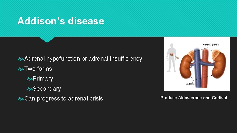 Addison’s disease Adrenal hypofunction or adrenal insufficiency Two forms Primary Secondary Can progress to Addison’s disease Adrenal hypofunction or adrenal insufficiency Two forms Primary Secondary Can progress to