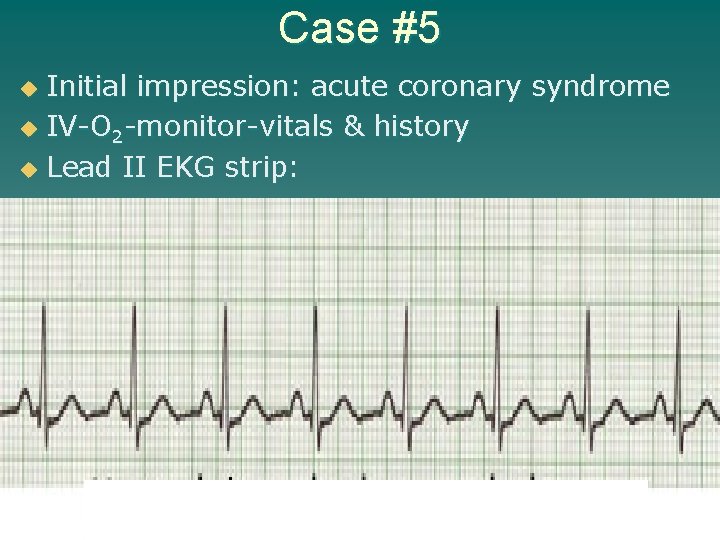 Case #5 Initial impression: acute coronary syndrome u IV-O 2 -monitor-vitals & history u