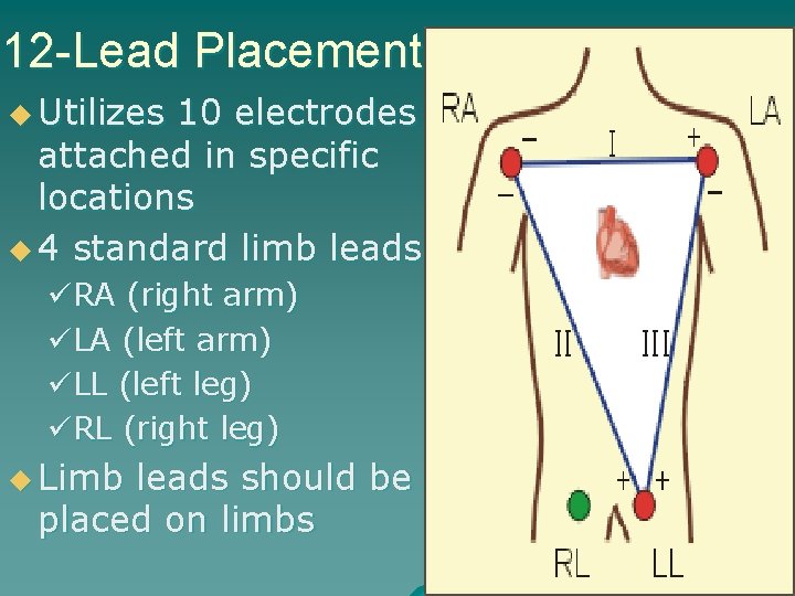 12 -Lead Placement u Utilizes 10 electrodes attached in specific locations u 4 standard