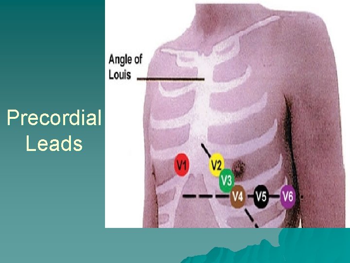 Precordial Leads 