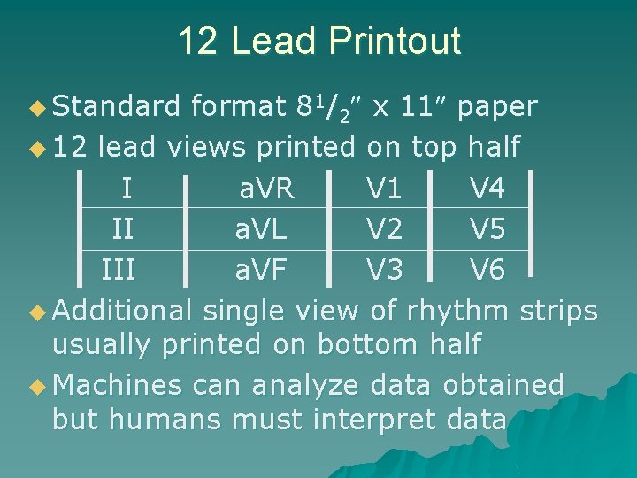 12 Lead Printout u Standard format 81/2 x 11 paper u 12 lead views