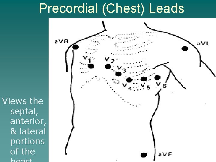 Precordial (Chest) Leads Views the septal, anterior, & lateral portions of the 