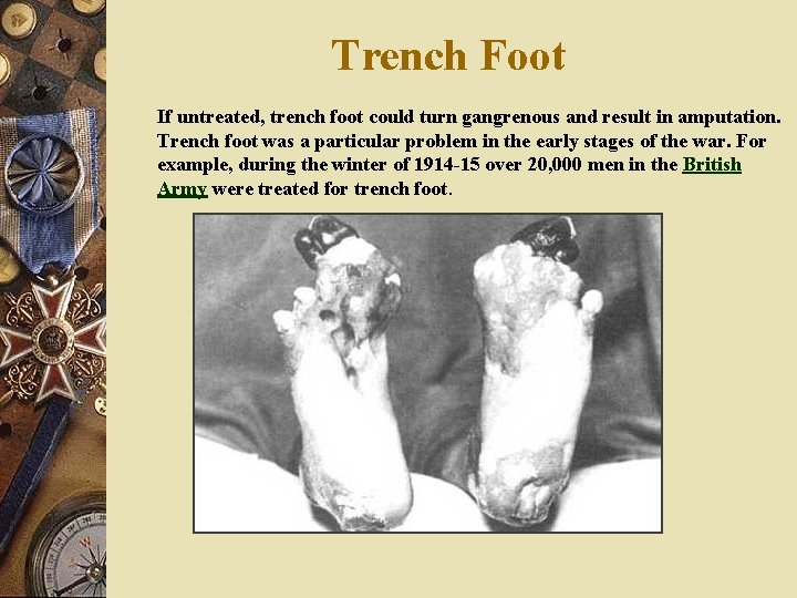 Trench Foot If untreated, trench foot could turn gangrenous and result in amputation. Trench