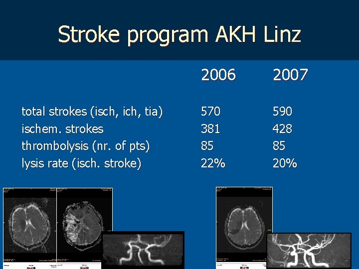 Stroke program AKH Linz total strokes (isch, ich, tia) ischem. strokes thrombolysis (nr. of