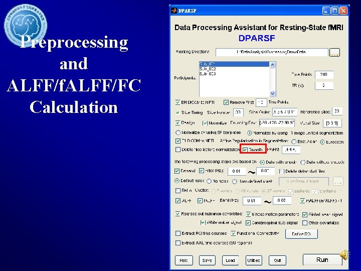 Preprocessing and ALFF/f. ALFF/FC Calculation 