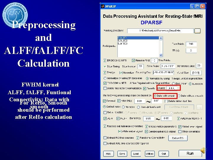 Preprocessing and ALFF/f. ALFF/FC Calculation FWHM kernel ALFF, f. ALFF, Funtional Connectivity: Data with