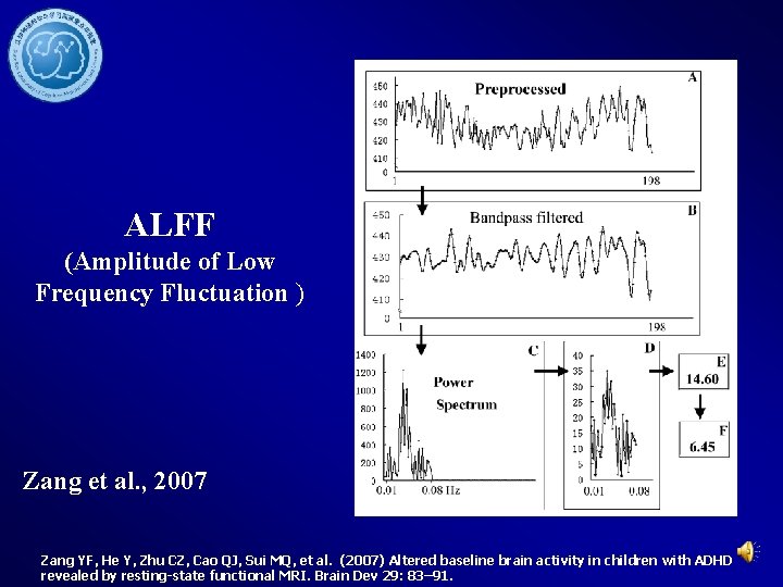 ALFF (Amplitude of Low Frequency Fluctuation ) Zang et al. , 2007 Zang YF,