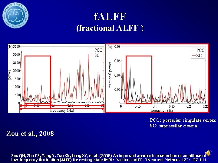 f. ALFF (fractional ALFF ) PCC: posterior cingulate cortex SC: suprasellar cistern Zou et