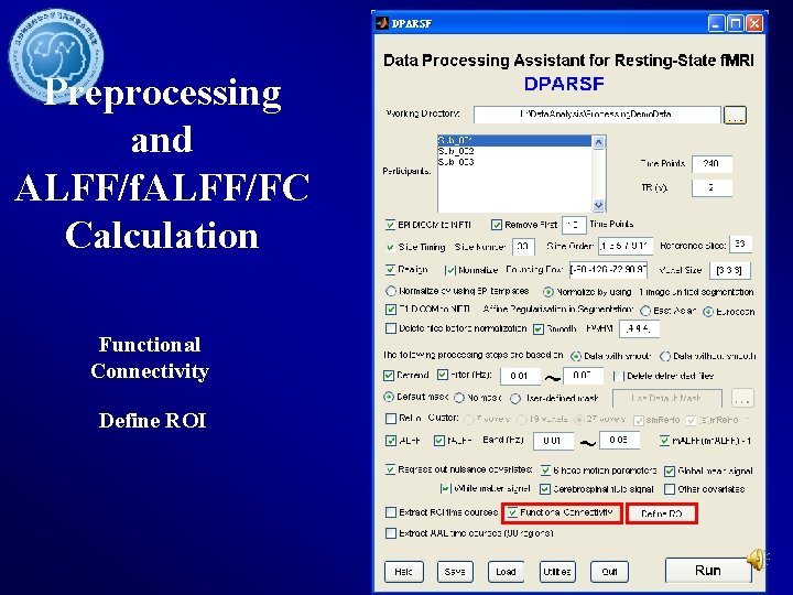 Preprocessing and ALFF/f. ALFF/FC Calculation Functional Connectivity Define ROI 