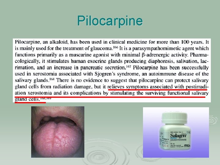 Pilocarpine 