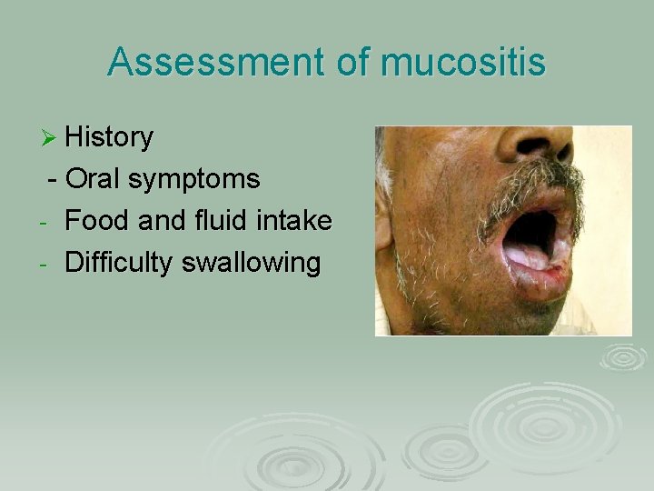 Assessment of mucositis Ø History - Oral symptoms - Food and fluid intake -