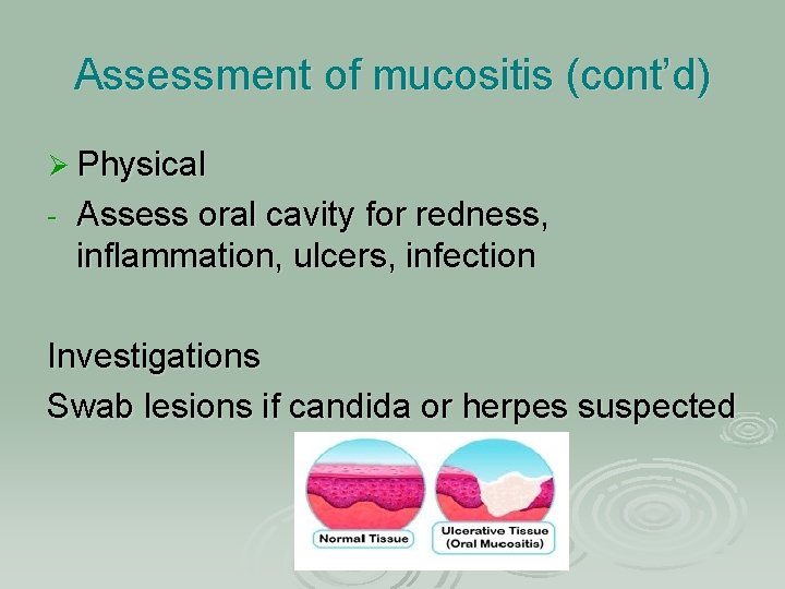 Assessment of mucositis (cont’d) Ø Physical - Assess oral cavity for redness, inflammation, ulcers,