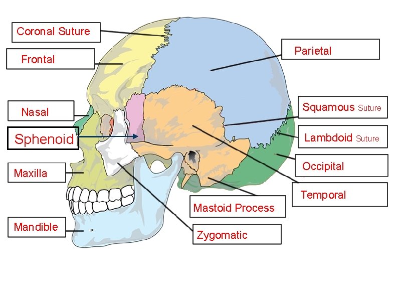 Coronal Suture Parietal Frontal Squamous Suture Nasal Sphenoid Lambdoid Suture Occipital Maxilla Temporal Mastoid