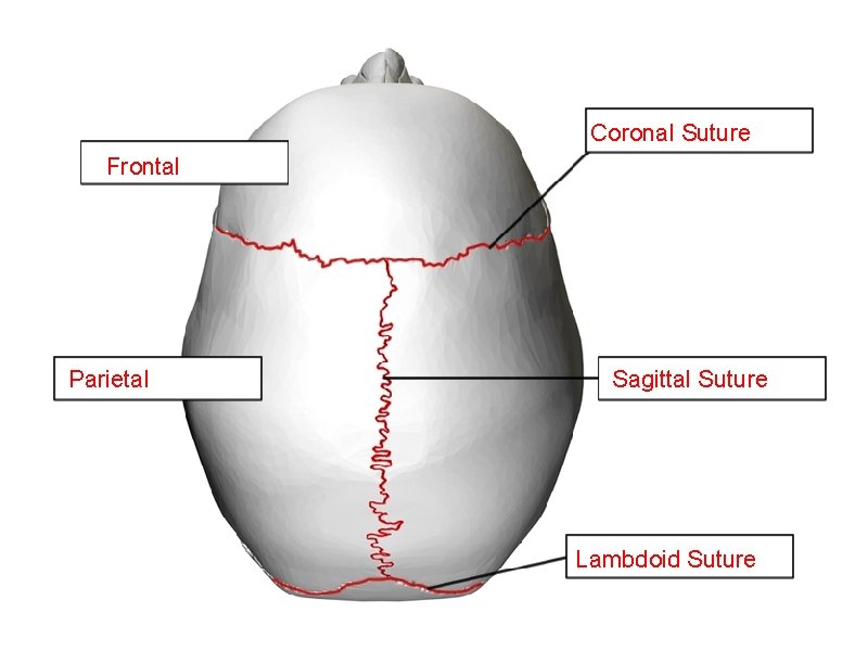 Coronal Suture Frontal Parietal Sagittal Suture Lambdoid Suture 