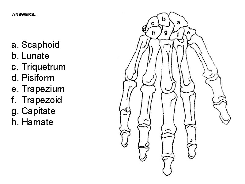 ANSWERS. . . a. Scaphoid b. Lunate c. Triquetrum d. Pisiform e. Trapezium f.