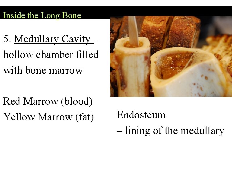 Inside the Long Bone 5. Medullary Cavity – hollow chamber filled with bone marrow