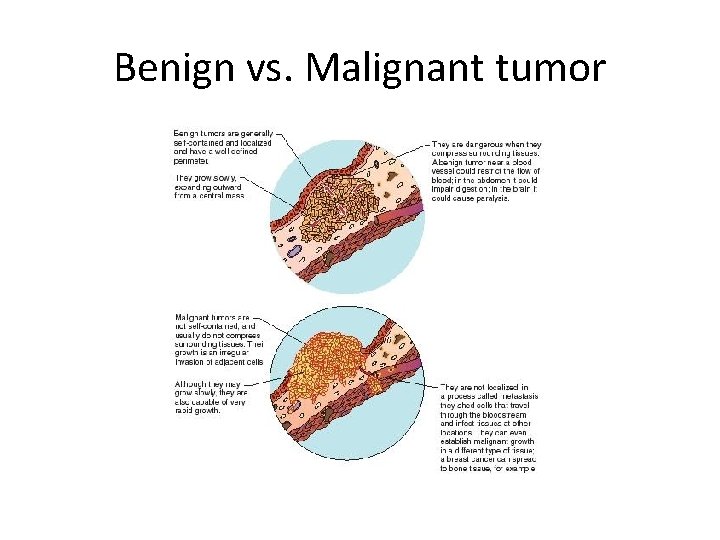 Benign vs. Malignant tumor 