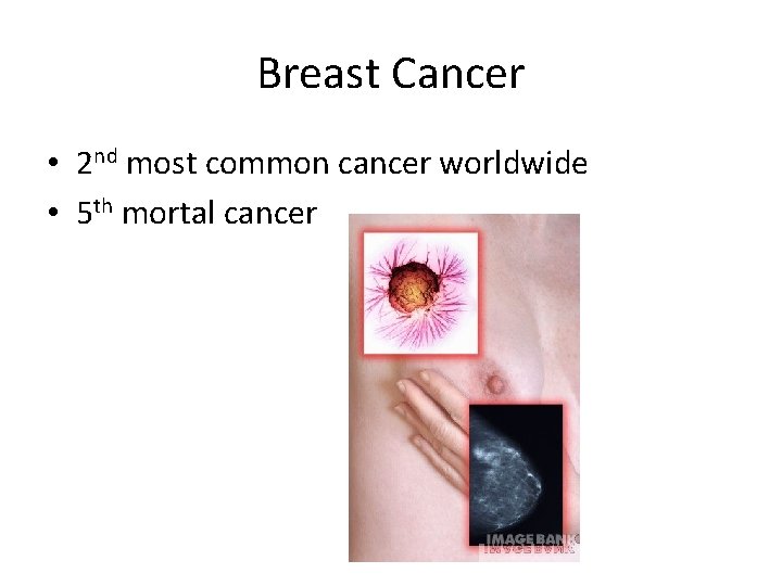 Breast Cancer • 2 nd most common cancer worldwide • 5 th mortal cancer