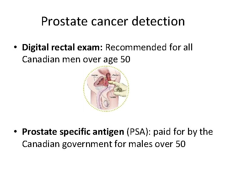 Prostate cancer detection • Digital rectal exam: Recommended for all Canadian men over age