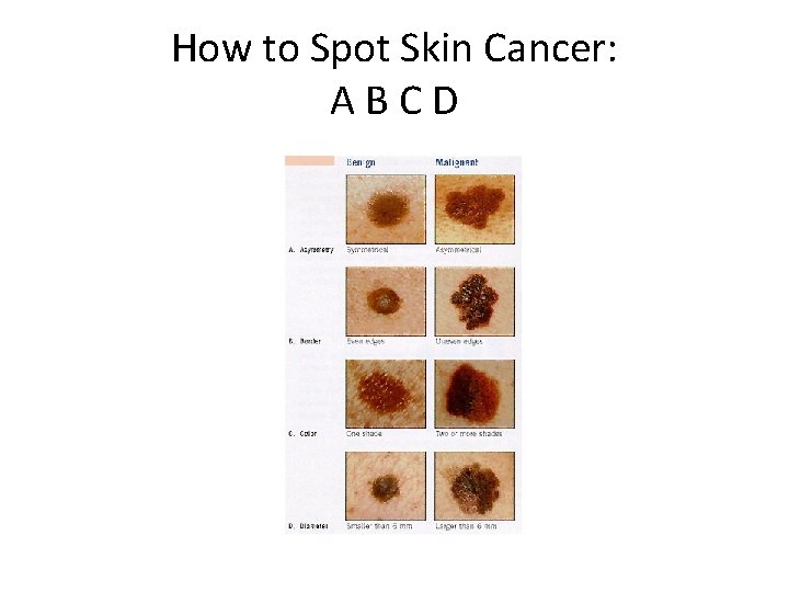 How to Spot Skin Cancer: ABCD 