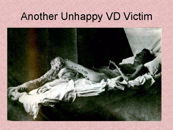 Another Unhappy VD Victim 