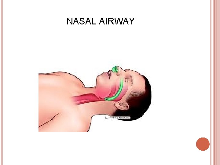 NASAL AIRWAY 