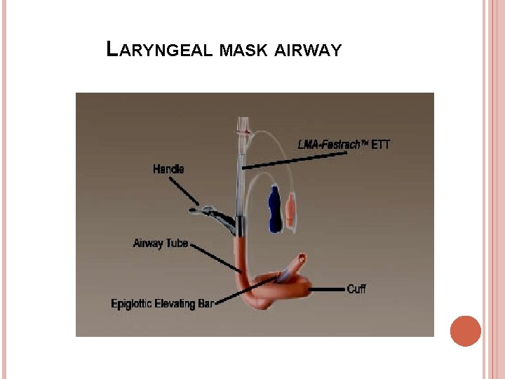 LARYNGEAL MASK AIRWAY 
