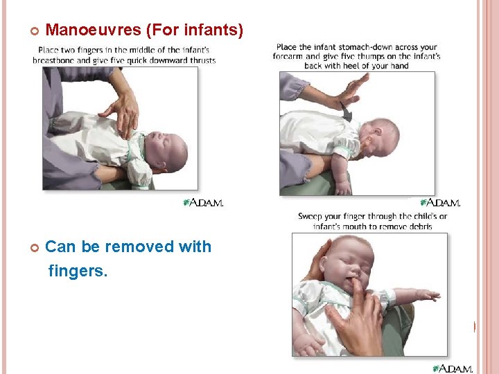  Manoeuvres (For infants) Can be removed with fingers. 