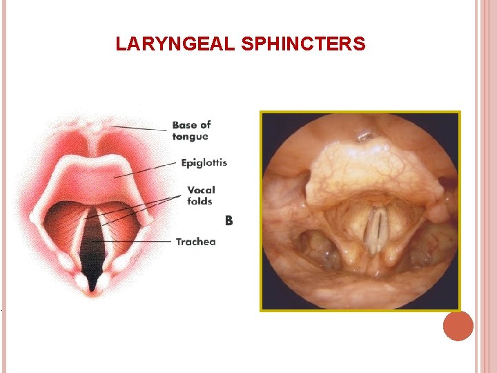LARYNGEAL SPHINCTERS 