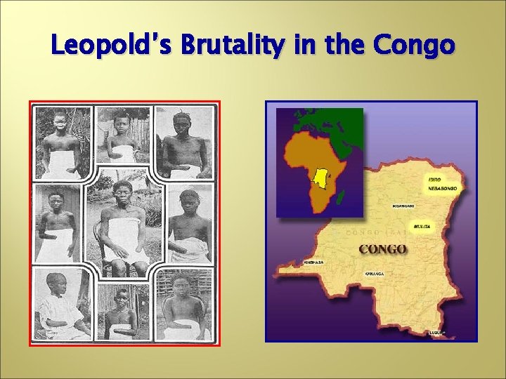 Leopold’s Brutality in the Congo 