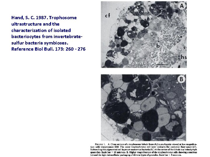 Hand, S. C. 1987. Trophosome ultrastructure and the characterization of isolated bacteriocytes from invertebratesulfur
