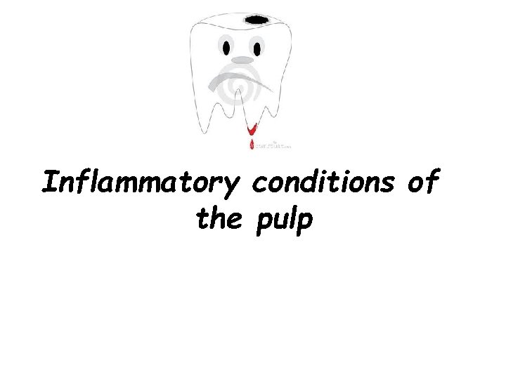 Inflammatory conditions of the pulp Inflammatory conditions of the pulp