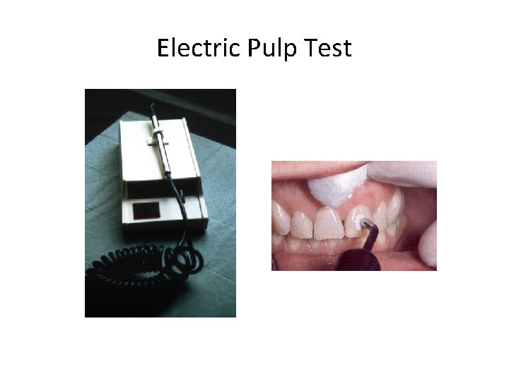 Electric Pulp Test Electric Pulp Test