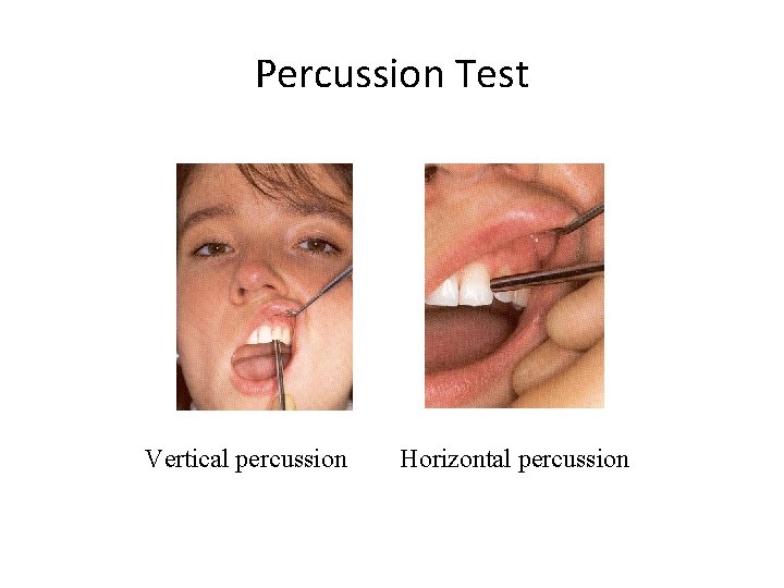 Percussion Test Vertical percussion Horizontal percussion Percussion Test Vertical percussion Horizontal percussion