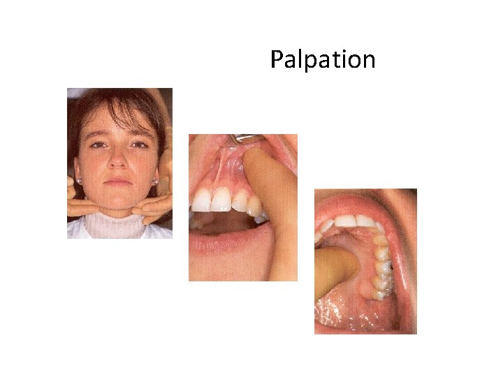 Palpation Palpation