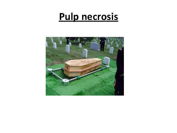Pulp necrosis Pulp necrosis
