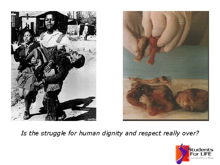 Is the struggle for human dignity and respect really over? 
