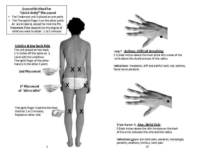 General Method for “Quick-Relief” Placement • The Treatment unit is placed on one point. General Method for “Quick-Relief” Placement • The Treatment unit is placed on one point.