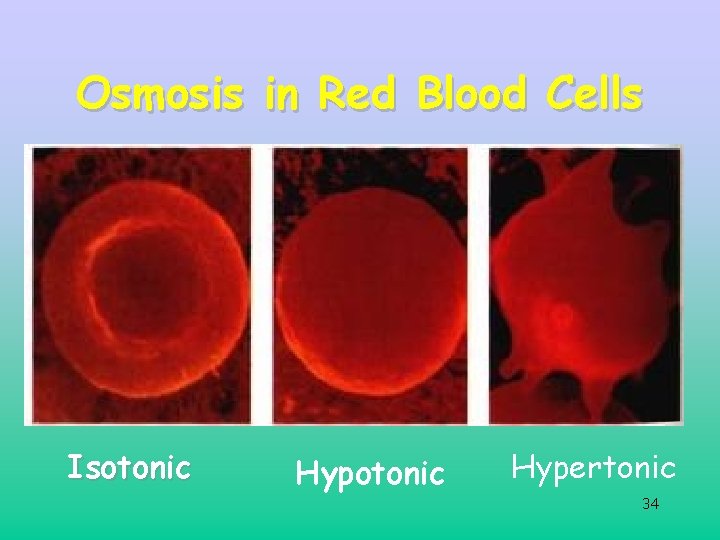 Osmosis in Red Blood Cells Isotonic Hypertonic 34 Osmosis in Red Blood Cells Isotonic Hypertonic 34