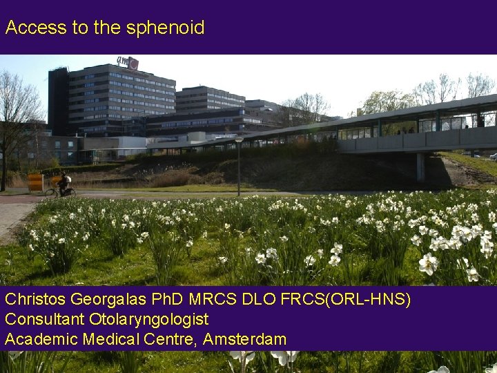 Access to the sphenoid Christos Georgalas Ph. D MRCS DLO FRCS(ORL-HNS) Consultant Otolaryngologist Academic