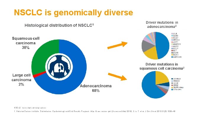 NSCLC is genomically diverse Histological distribution of NSCLC 1 Driver mutations in adenocarcinoma 2