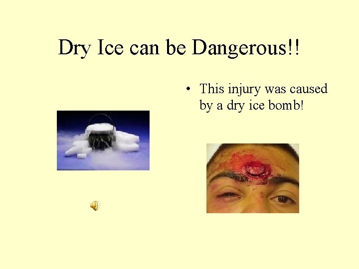 Dry Ice can be Dangerous!! • This injury was caused by a dry ice