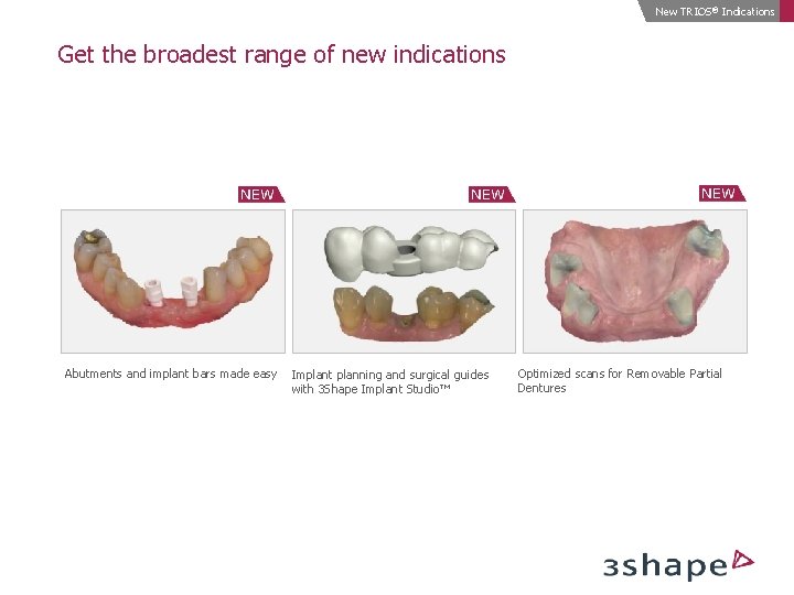 New TRIOS® Indications Get the broadest range of new indications Abutments and implant bars