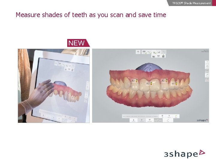 TRIOS® Shade Measurement Measure shades of teeth as you scan and save time 