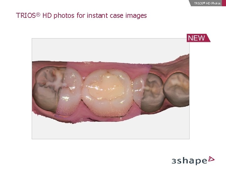 TRIOS® HD Photos TRIOS® HD photos for instant case images 