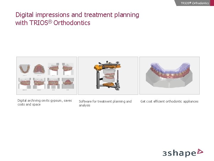 TRIOS® Orthodontics Digital impressions and treatment planning with TRIOS® Orthodontics Digital archiving omits gypsum,